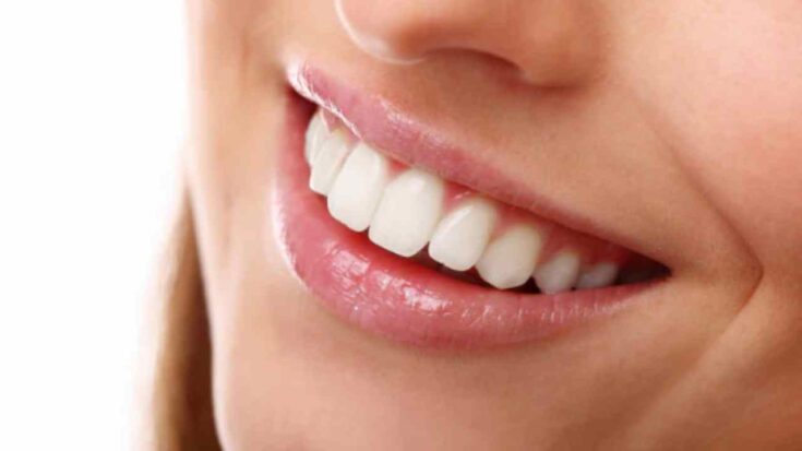 sonrisa perfecta